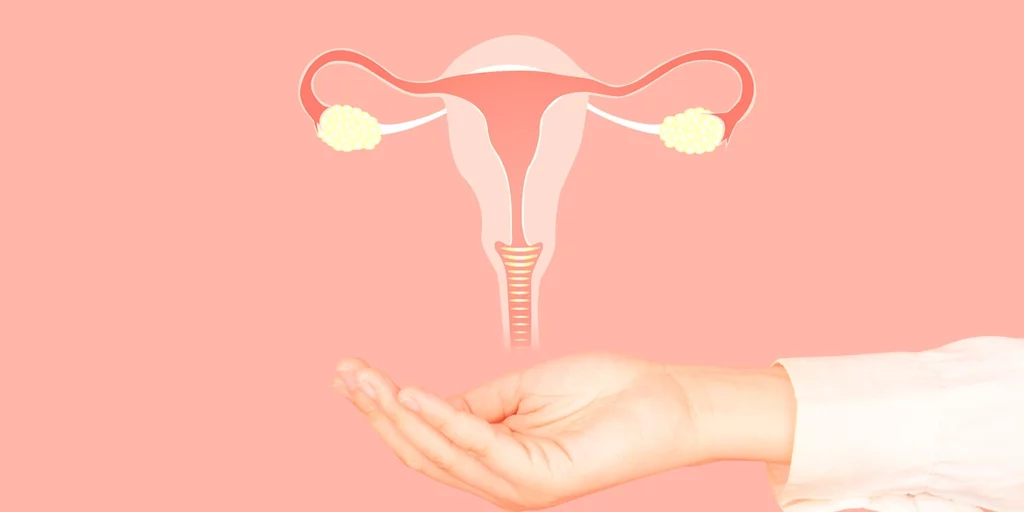 Protocolo de Prevenção da Síndrome de Hiperestimulação Ovariana Moderada e Grave